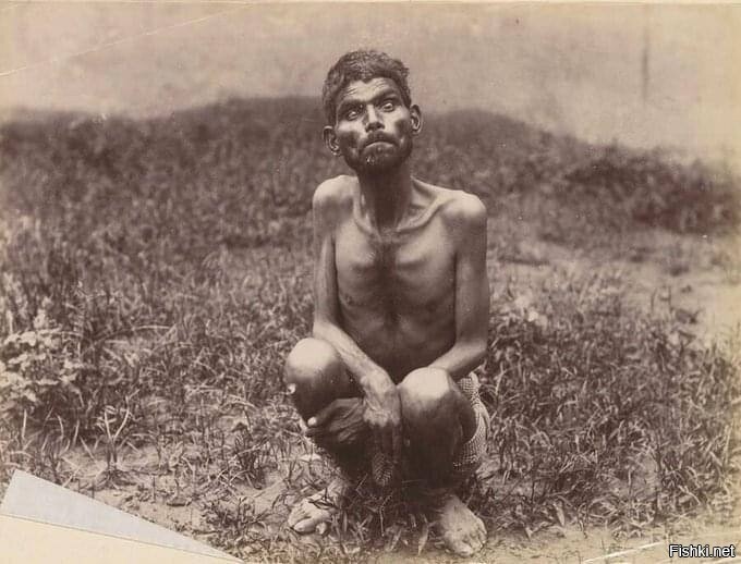 Дина Саничар, обнаруженный охотниками в джунглях в 1867 году, в первые годы с...