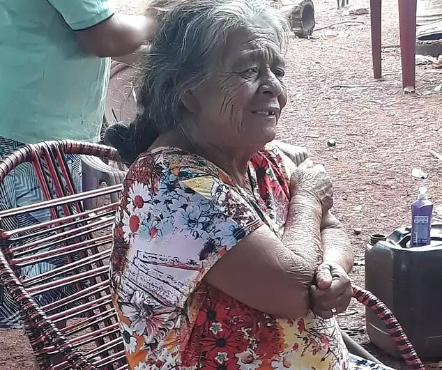 81-летняя женщина 56 лет прожила с «каменным ребёнком» в животе