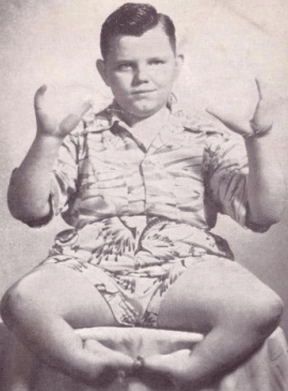 Грейди Стайлз-младший – мальчик-омар и его судьба