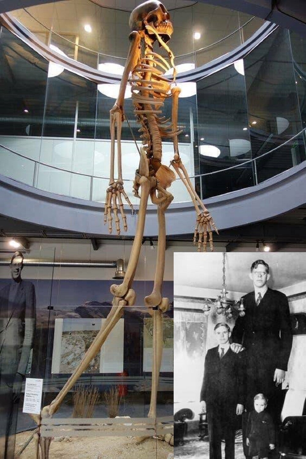 7. Скелет Роберта Уодлоу, самого высокого человека в истории (272 см)