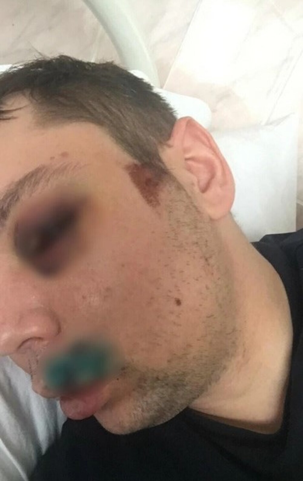 «Их здесь отмажут»: общественник жёстко прокомментировал избиение парня кавказцами в Екатеринбурге