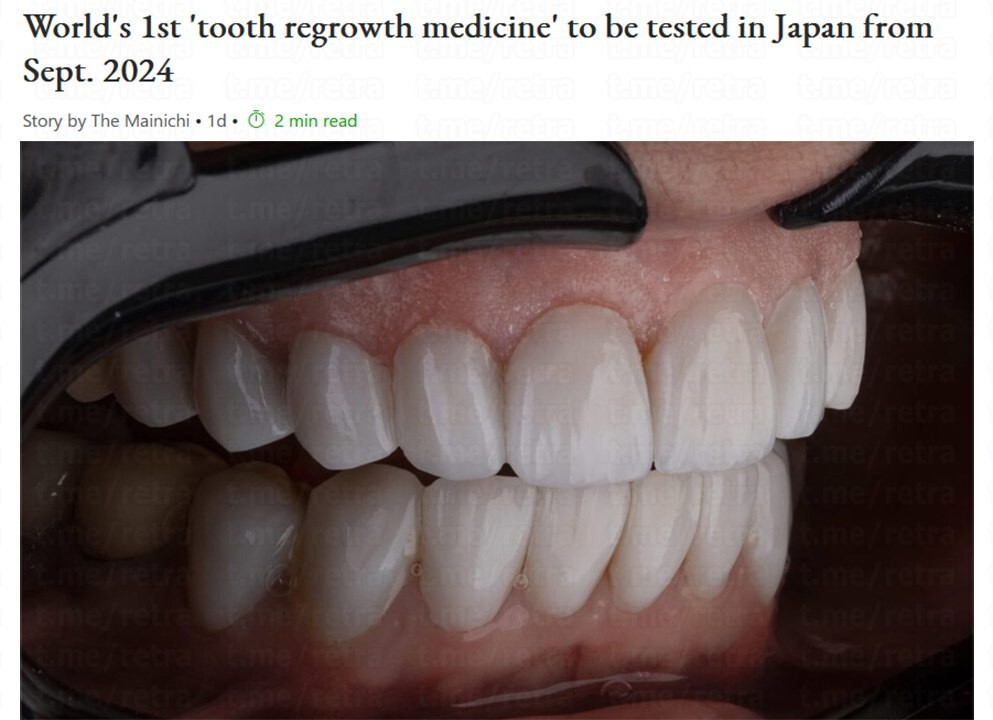 Первое в мире «лекарство для роста зубов» будет испытано в Японии с сентября 2024 года