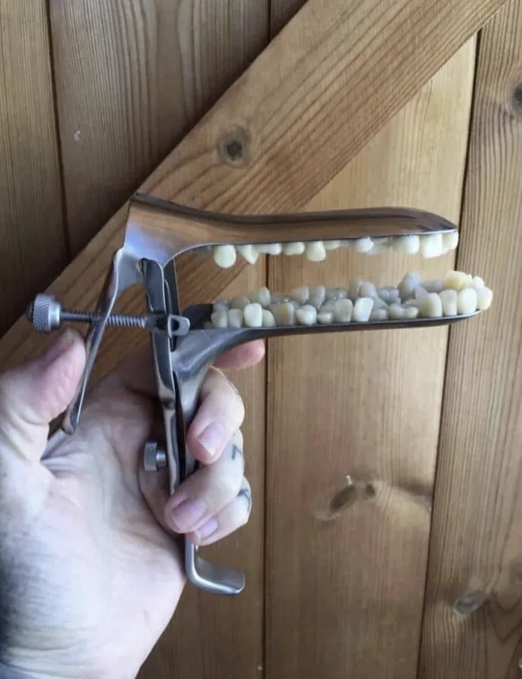 19. И, наконец, этот гинекологический инструмент с зубами