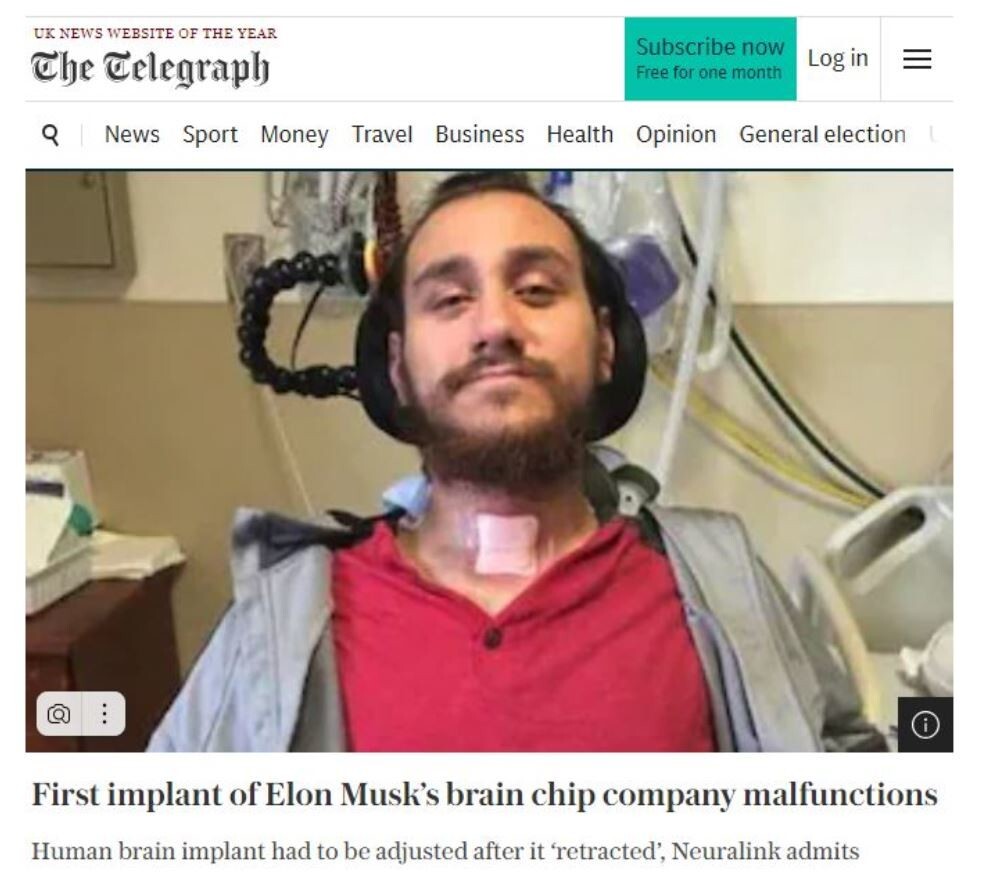 Компания Neuralink сообщила о сбое в работе нейрочипа, вживленного в мозг человека