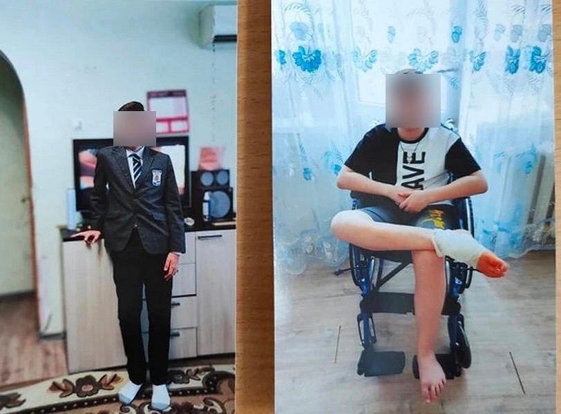 В Уфе школьник стал терять память и начал седеть после того, как обратился к врачам из-за занозы в ноге