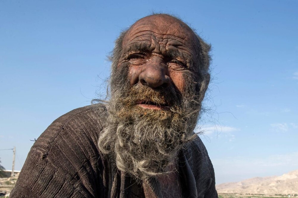 Аму Хаджи: история иранца, который не мылся 67 лет