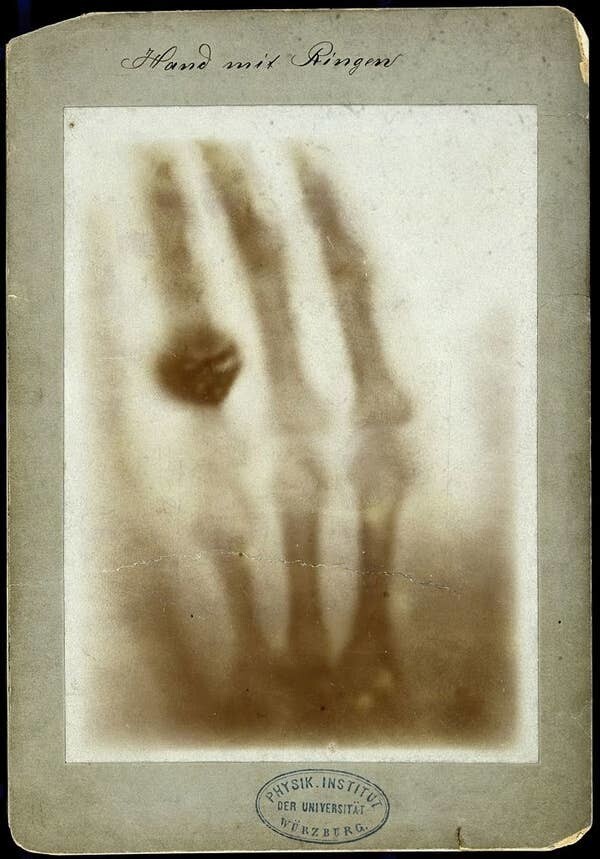 6. Первый в истории рентгеновский снимок, сделанный Вильгельмом Конрадом Рентгеном в 1895 году