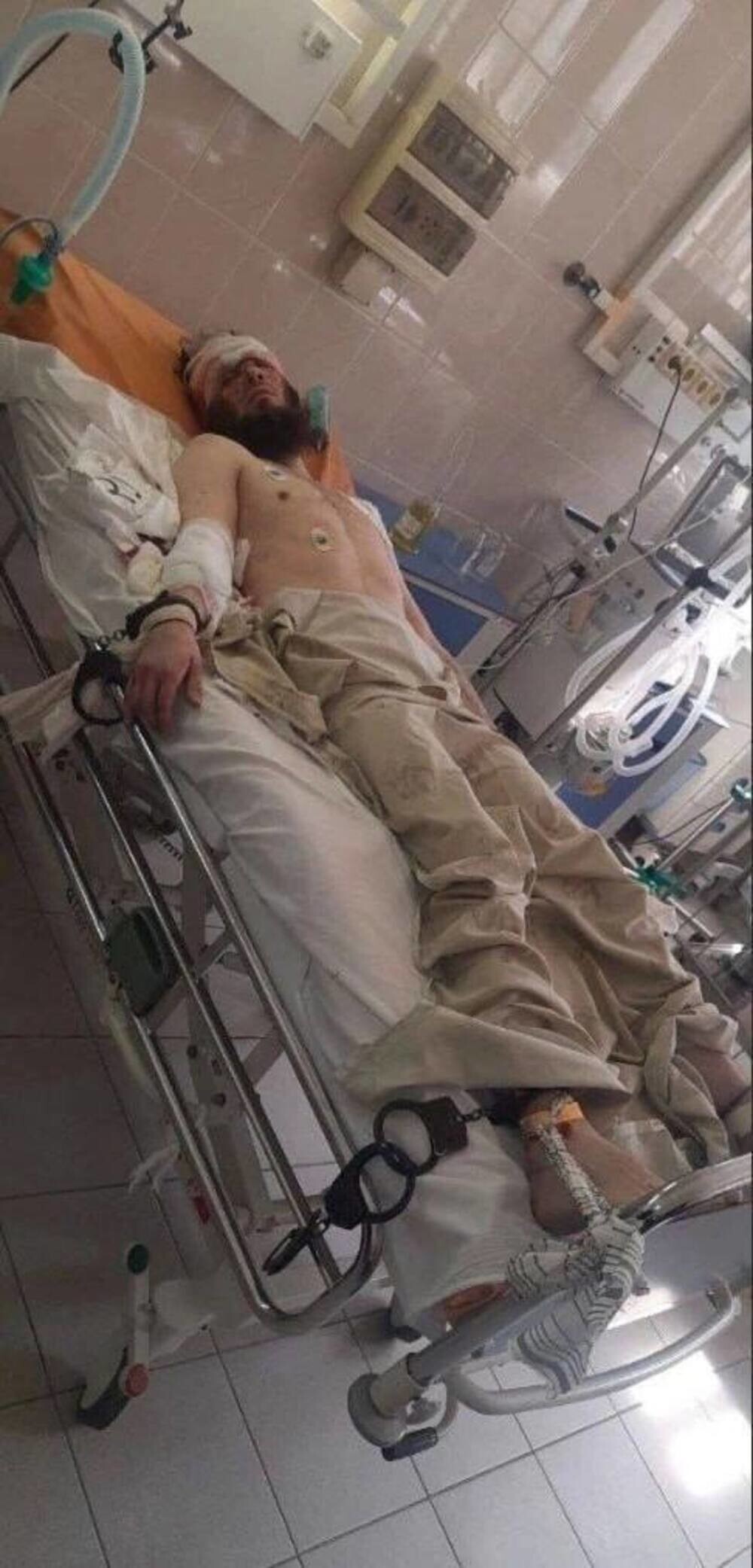 Террорист, получивший ранение в голову при штурме ростовского СИЗО, пришёл в сознание
