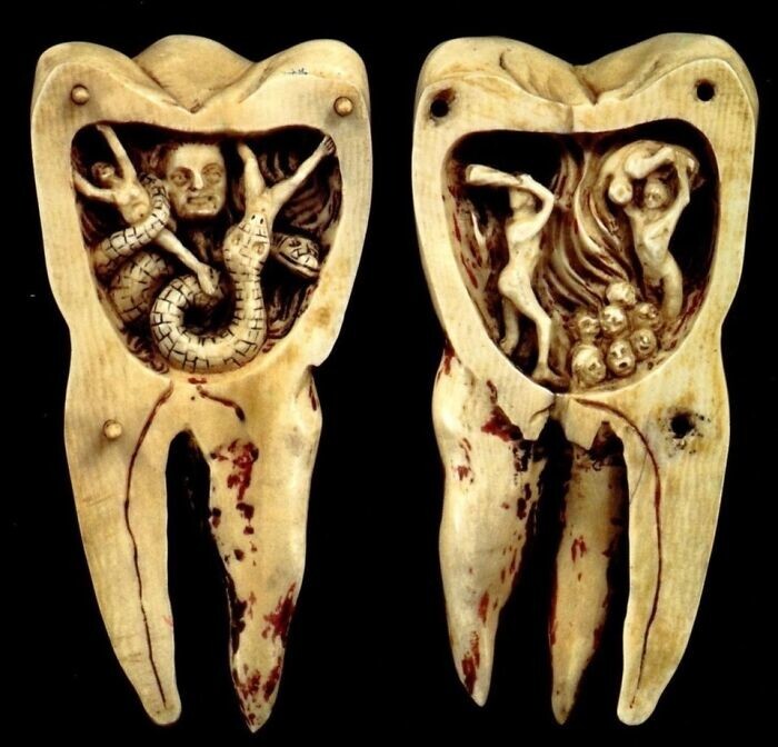 25. «Зубной червь как адский демон», 18 век. Зубной червь, как считали многие в прошлом, проделывает дырки в зубах и вызывает зубную боль