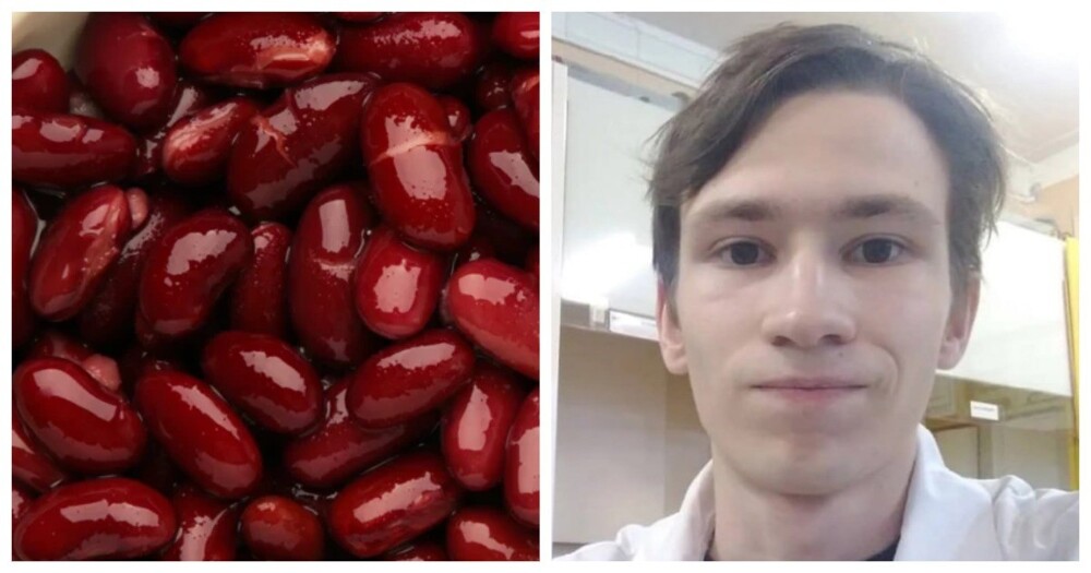 В Костромской области от ботулизма скончался студент, перекусивший салатом с отравленной фасолью