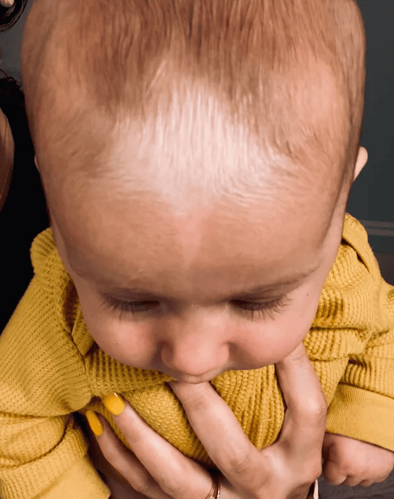 У девочки на голове есть родимое пятно необычной формы