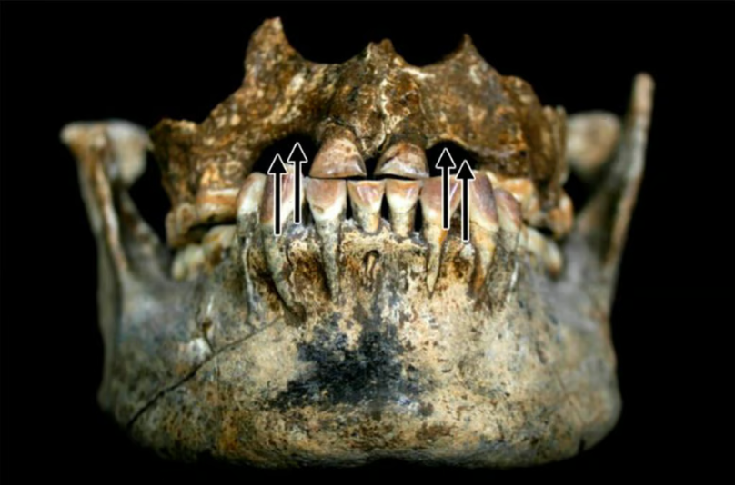 Зачем тайваньцы 5 000 лет вырывали себе передние зубы