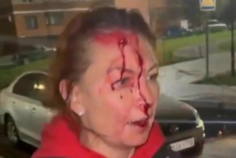 Пьяные приезжие напали на супружескую пару и заработали уголовное дело