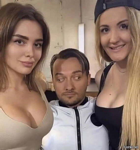 Хитрое косоглазие