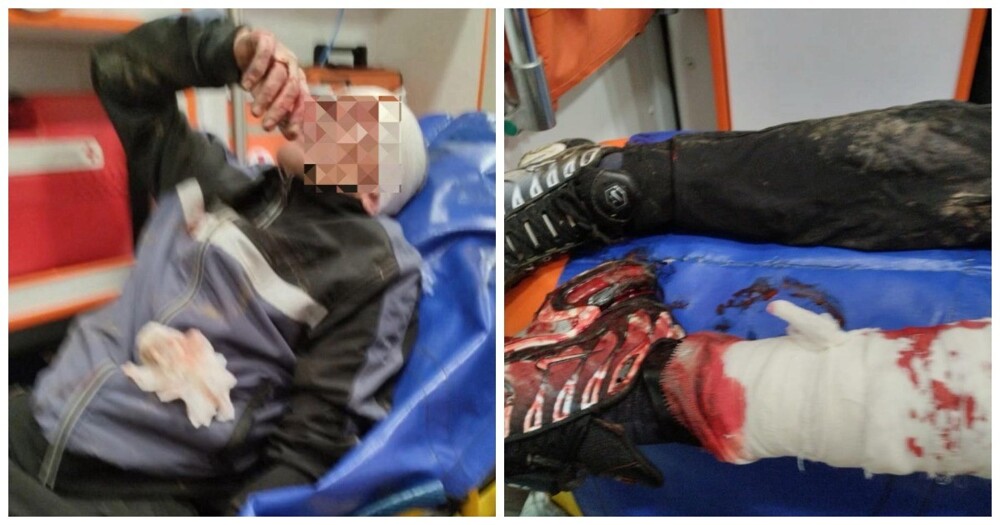 В Каменске-Уральском женщина натравила бойцовых псов на мужчину и поплатилась