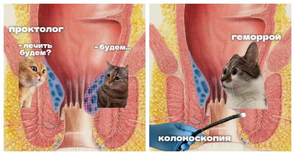 Нестандартная реклама операции по удалению геморроя