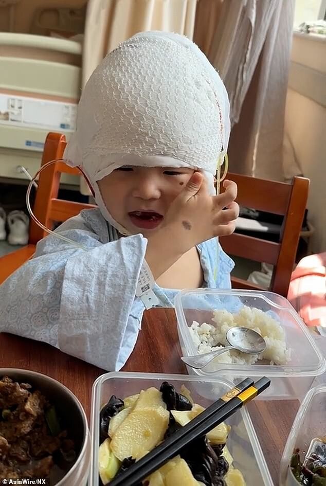 Мальчик, которого прозвали Микки Маусом, преобразился