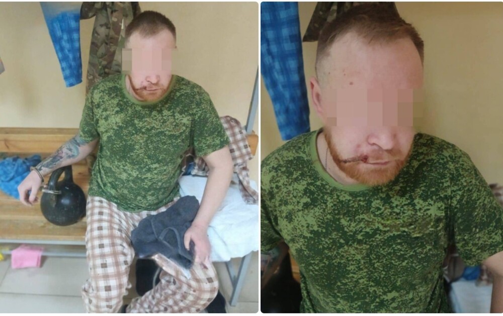 Контрактника с Кубани пытают в медроте: сломаны пальцы, к рукам приковали гирю