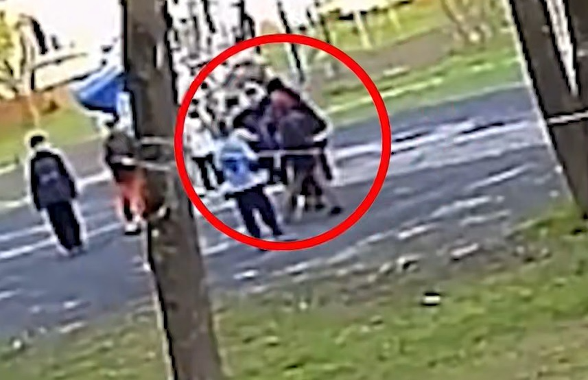 В Обнинске мамаша порвала чужому ребёнку губу за то, что дети во дворе случайно задели мячом её чадо
