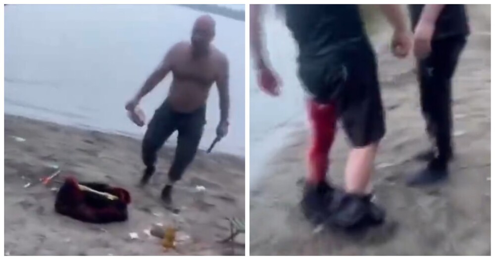 Рыбак получил ножевое ранение в Новосибирске