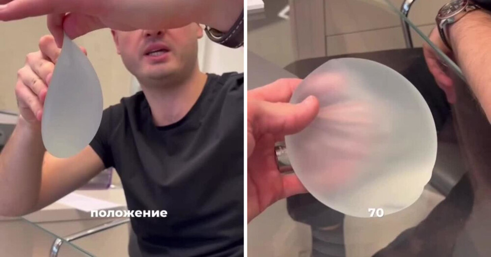 Самые дорогие импланты