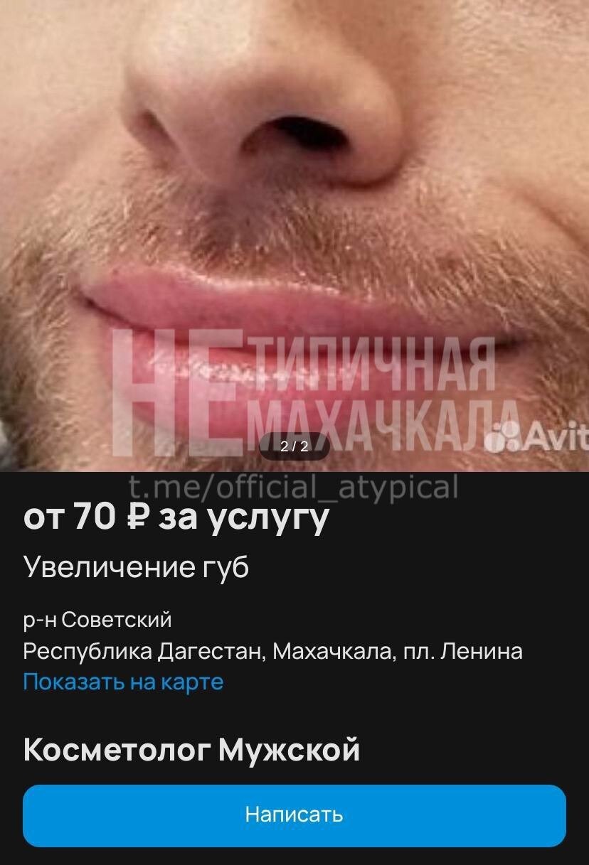 "Куда ваши женщины смотрят!" : на Кавказе мужчины увлеклись увеличением губ и ношением никабов