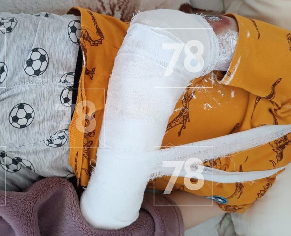 Руку мальчика затянуло в досмотровую установку на вокзале