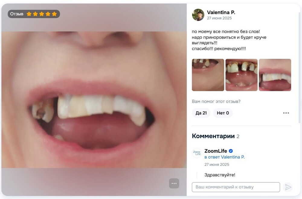 "Это очень опасно!": россияне на фоне высоких цен на стоматологию стали скупать наборы для самостоятельного пломбирования зубов