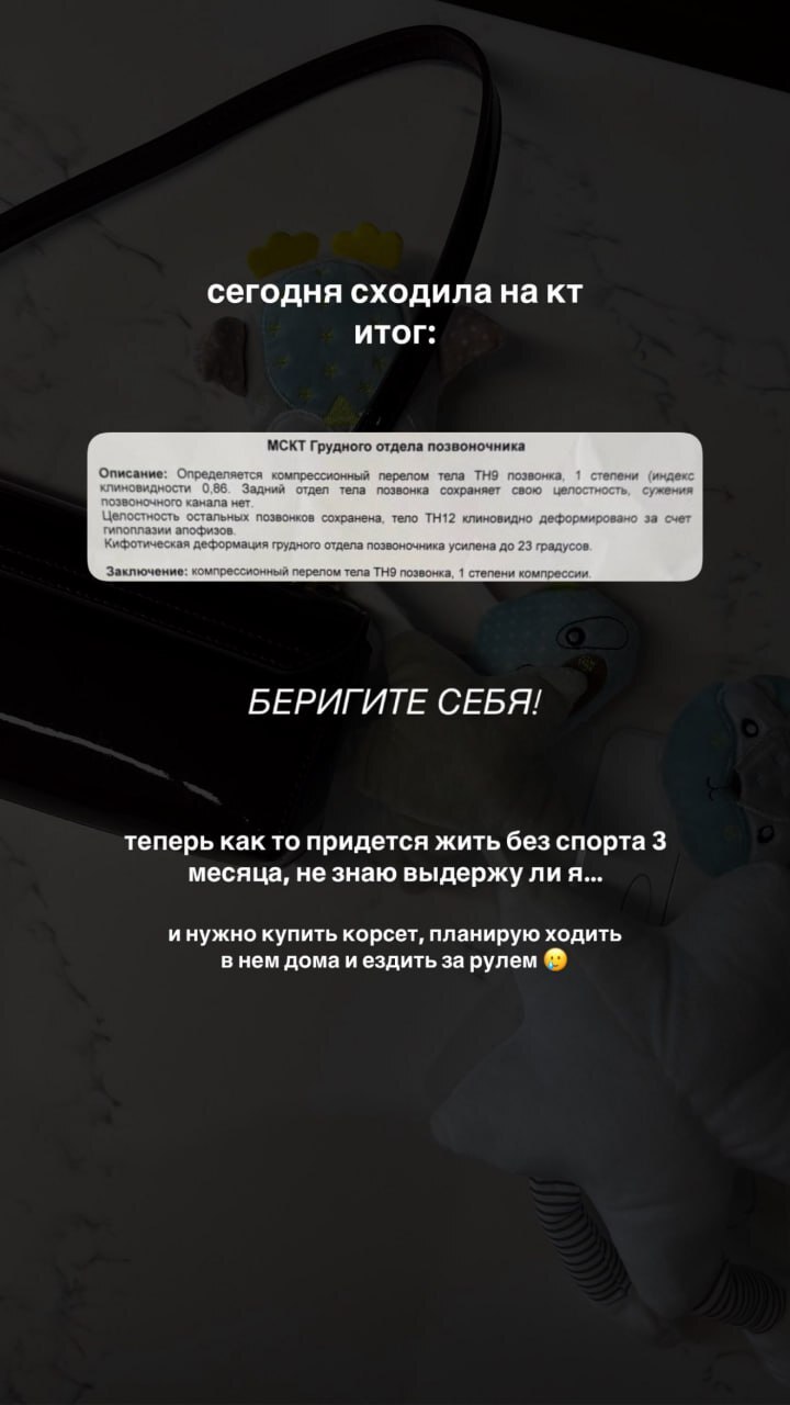 Жительница Екатеринбурга сломала позвоночник, повторяя вирусный тренд из TikTok