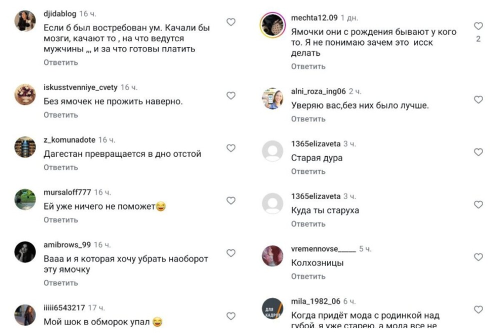 Новый модный тренд: кавказские девушки делают ямочки на щеках, чтобы выглядеть моложе и милее