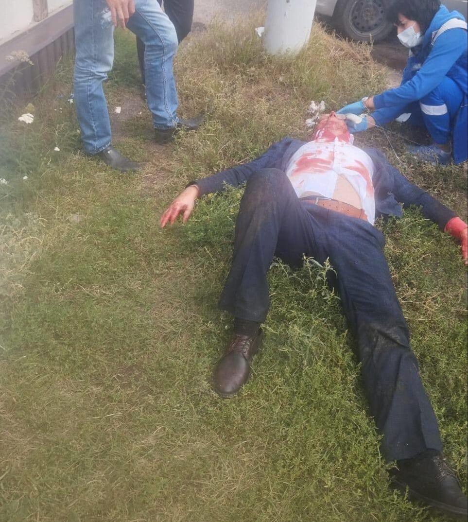 Чиновника в Пензенской области избили металлической трубой за оскорбление "свиньёй"