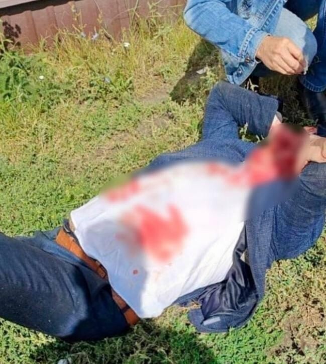 Глава администрации Каменского района Пензенской области Александр Помогайбо был избит мигрантом монтировкой после конфликта из-за антисанитарии на частном участке