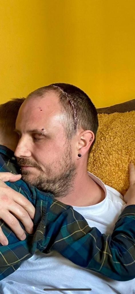 Мужчина играл на гитаре, пока ему удаляли опухоль мозга