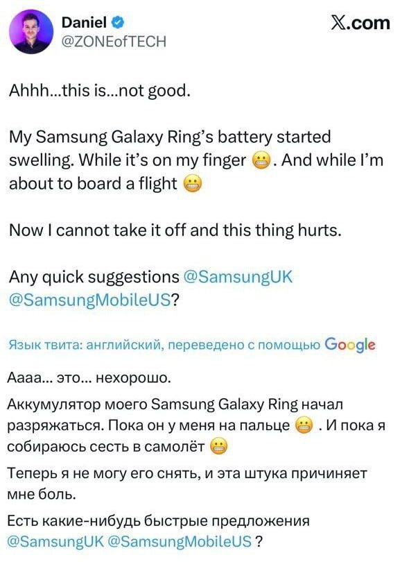 Мужчина чуть не потерял палец из-за умного кольца Samsung