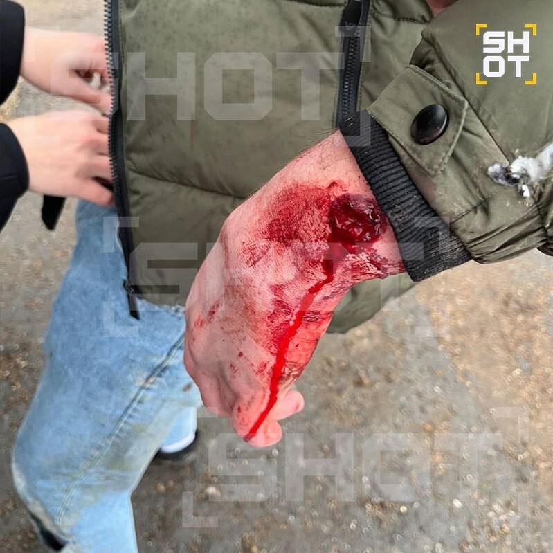 В Башкирии общественник под видом полицейского расстрелял из травмата компанию из-за громкой музыки