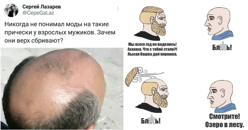 Облысению конец? Тайваньские учёные создали уникальную сыворотку Облысению конец? Тайваньские учёные создали уникальную сыворотку