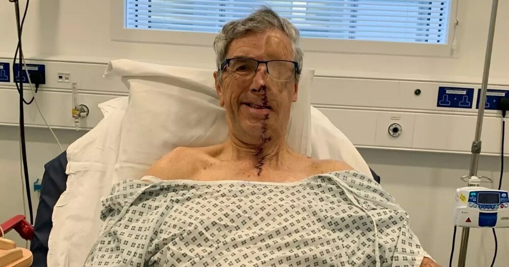 Пострадавшему в аварии британцу напечатали лицо на 3D-принтере Пострадавшему в аварии британцу напечатали лицо на 3D-принтере