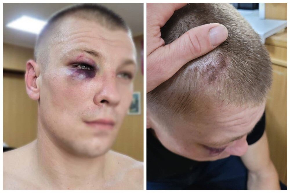 "Извиняюсь за земляков": глава дагестанской диаспоры Астраханской области повинился за жестокое избиение русских парней "Извиняюсь за земляков": глава дагестанской диаспоры Астраханской области повинился за жестокое избиение русских парней