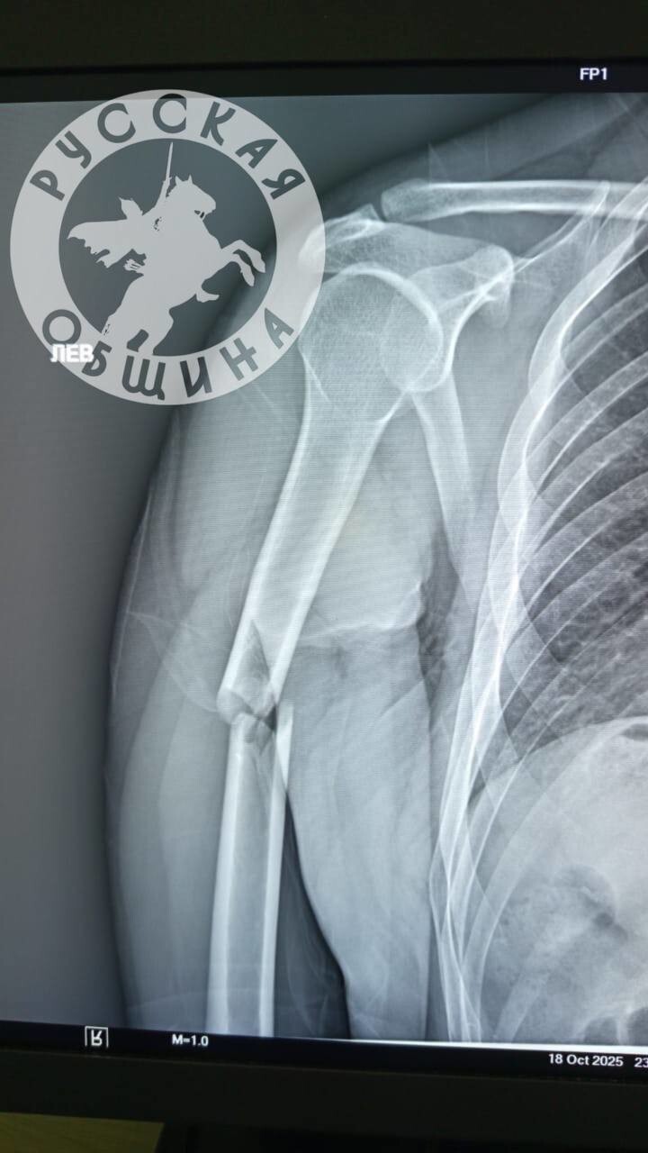 "Извиняюсь за земляков": глава дагестанской диаспоры Астраханской области повинился за жестокое избиение русских парней "Извиняюсь за земляков": глава дагестанской диаспоры Астраханской области повинился за жестокое избиение русских парней