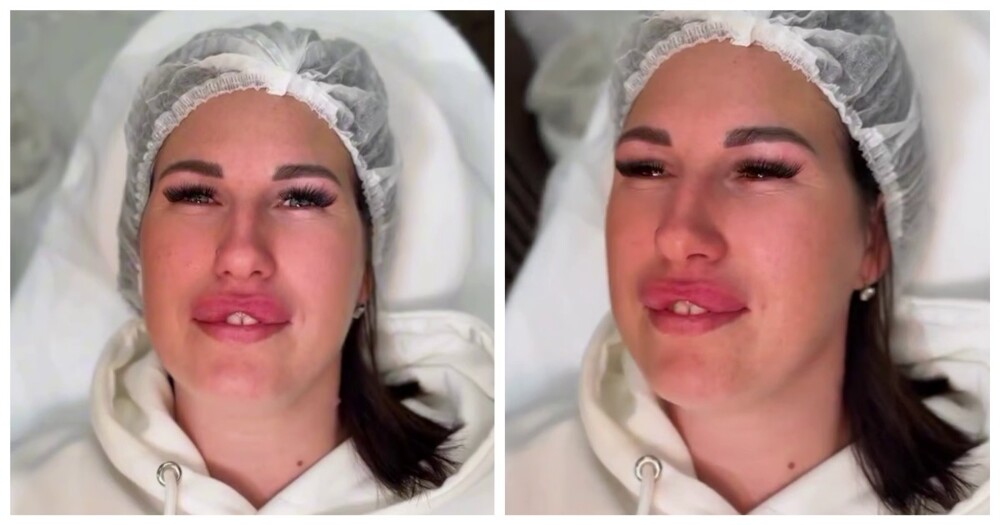 Как выглядит эффект «заячьих губок» Как выглядит эффект «заячьих губок»