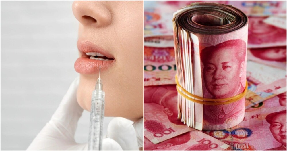 Миллион на силикон: как китаянка превратила парня своей подруги в спонсора "идеальных губ"