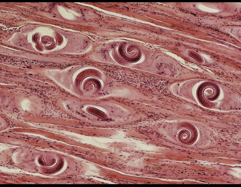 Почему есть мясо медведя смертельно опасно?