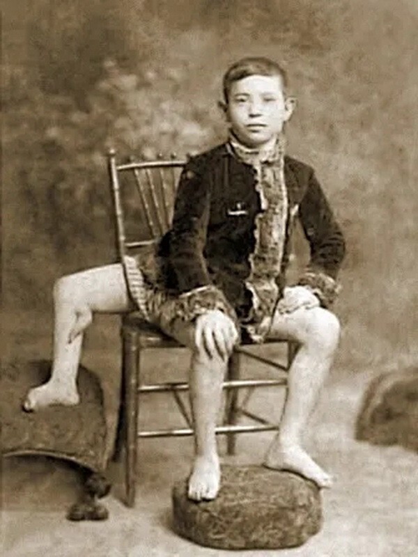 Так как мальчик родился во времена, когда искусство фотографии расцветало, подлинность его кондиций подтверждает множество фотодокументов