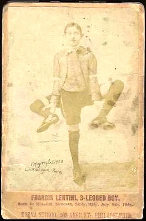 Лишнее.Франческо Лентини