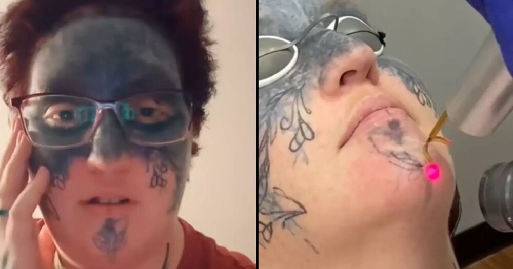 Женщина сводит с лица насильно нанесённые татуировки