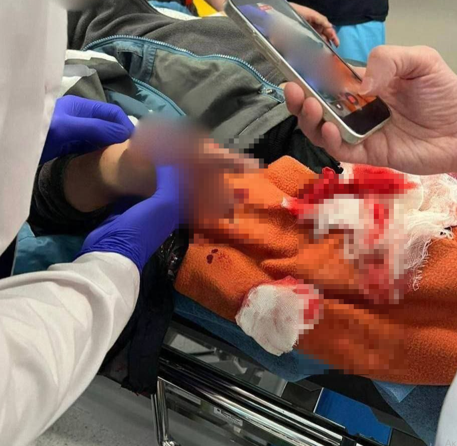 В Подмосковье мальчик лишился двух пальцев, подняв с земли подарочную упаковку с СВУ внутри