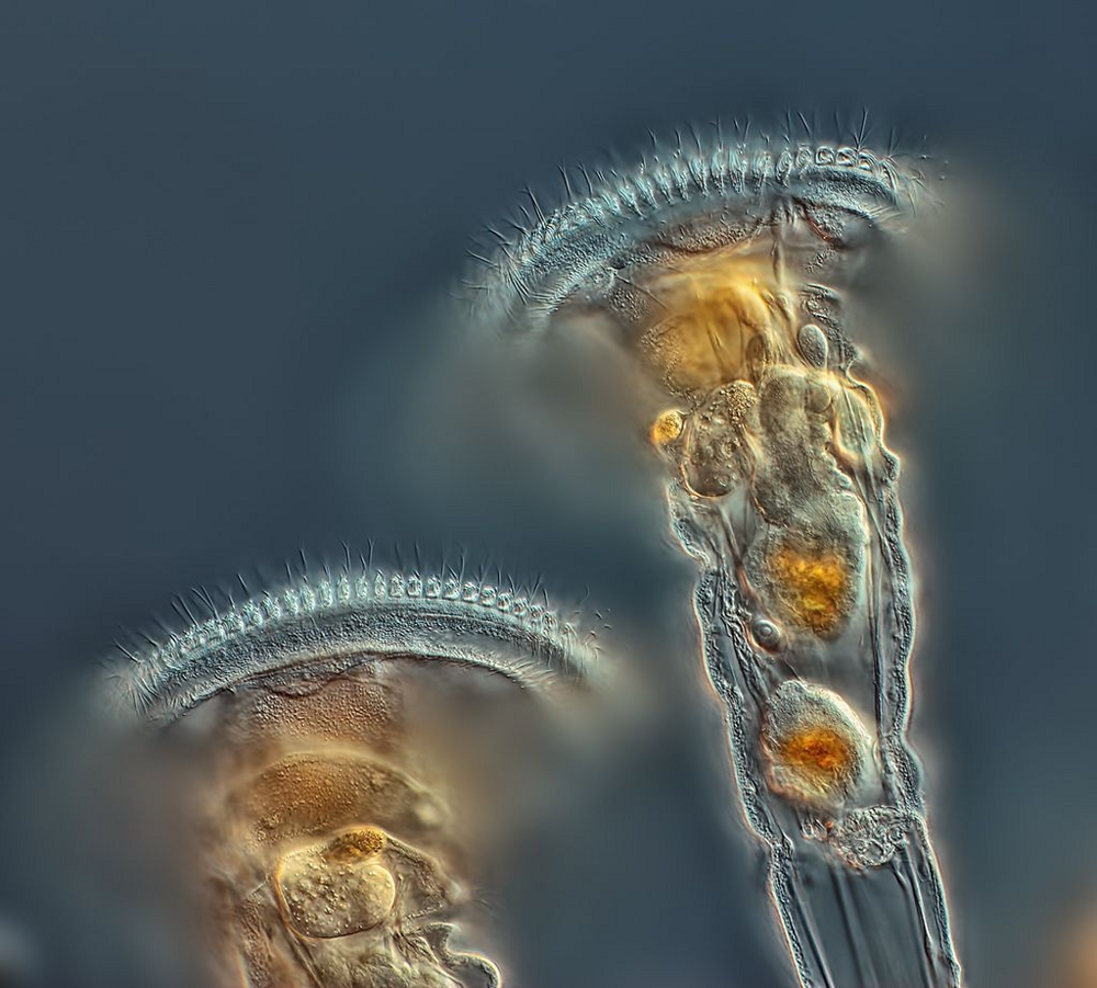 Коловратка: живёт в соседней луже и спит по 25 тысяч лет