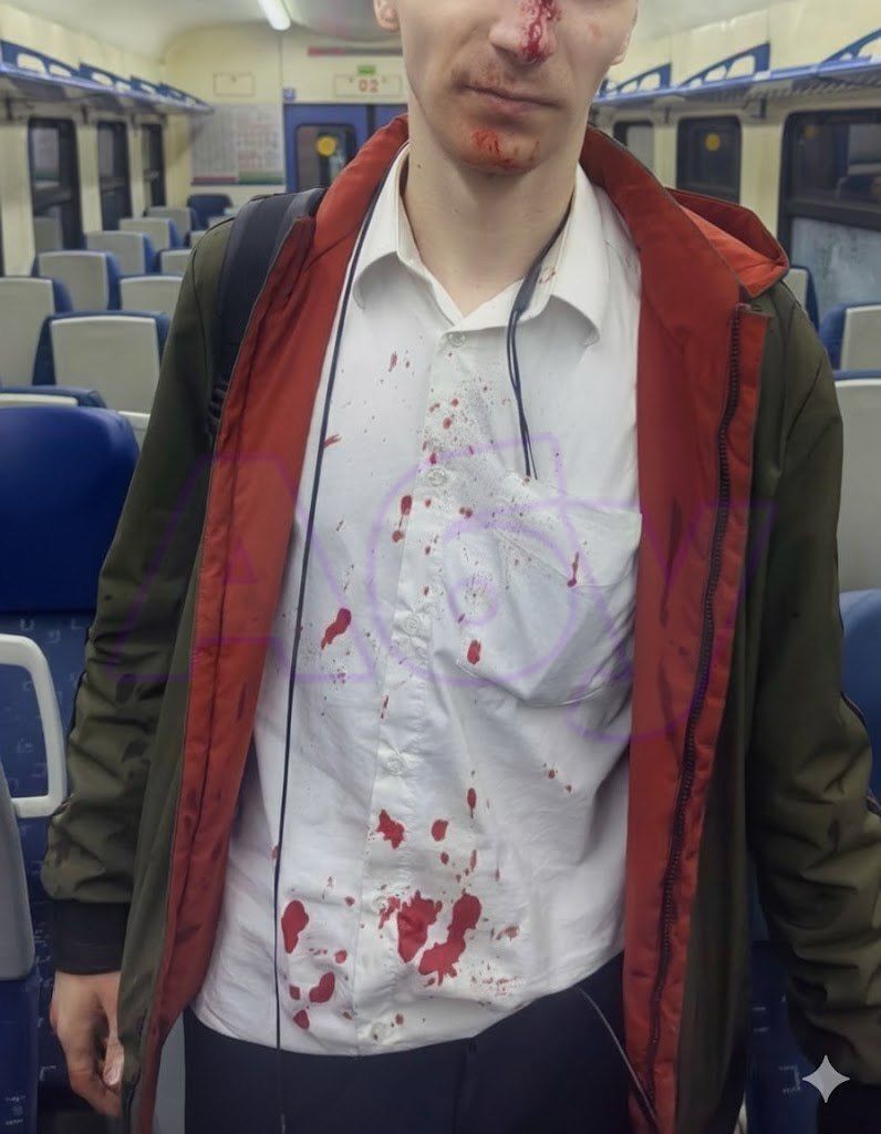 В Подмосковье банда подростков разгромила электричку и ранила помощника машиниста