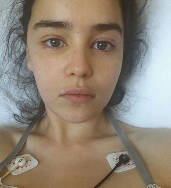 6 звёзд, которых не сломила тяжёлая болезнь