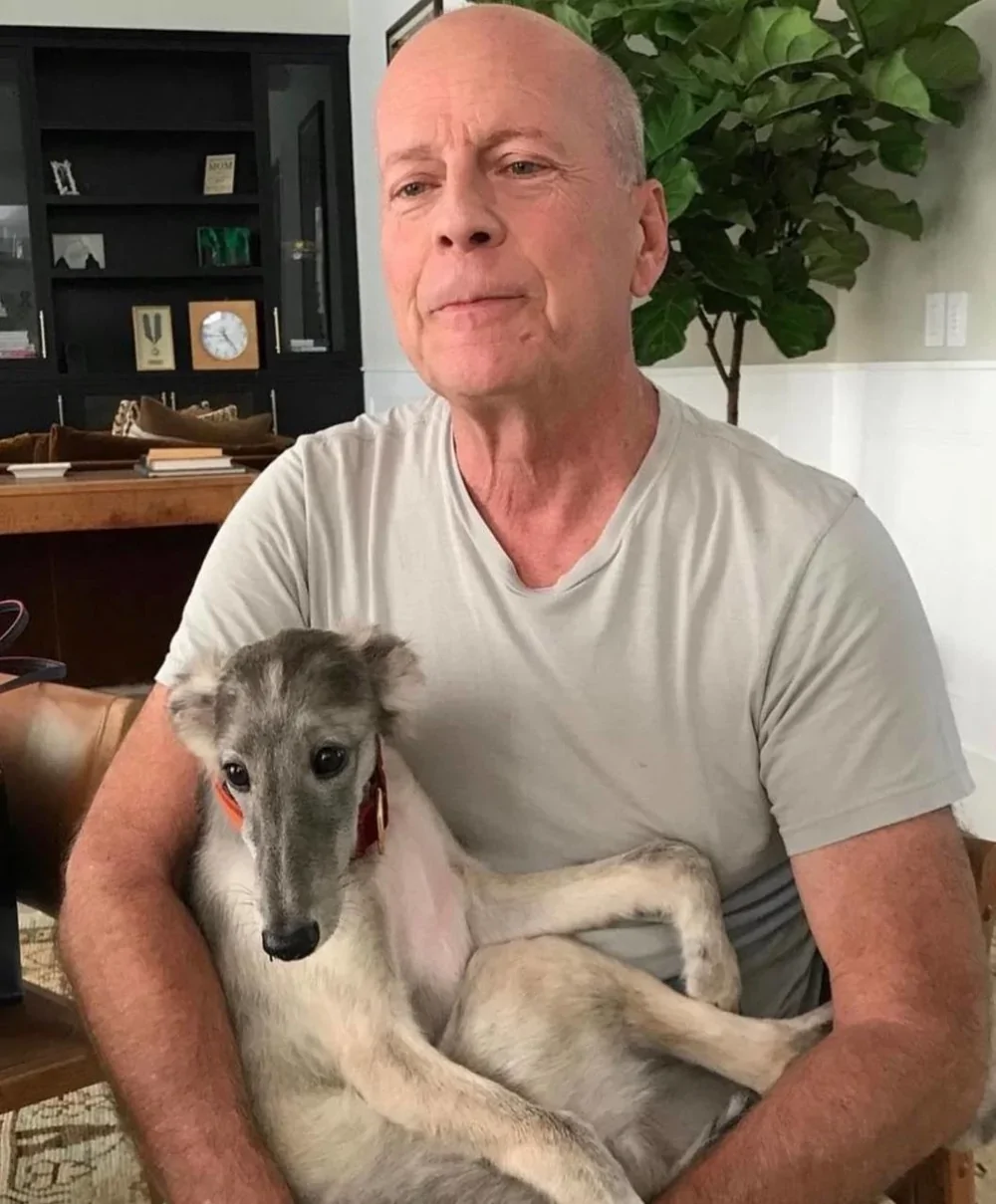 Семья Брюса Уиллиса решила пожертвовать его мозг для научных исследований